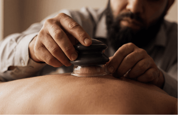 Cupping therapy treatment